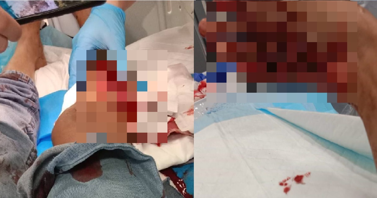 WOMAN’S FLESH BITTEN OFF BY WILD BOAR @ BUKIT PANJANG, BOAR CAUGHT & EUTHANISED