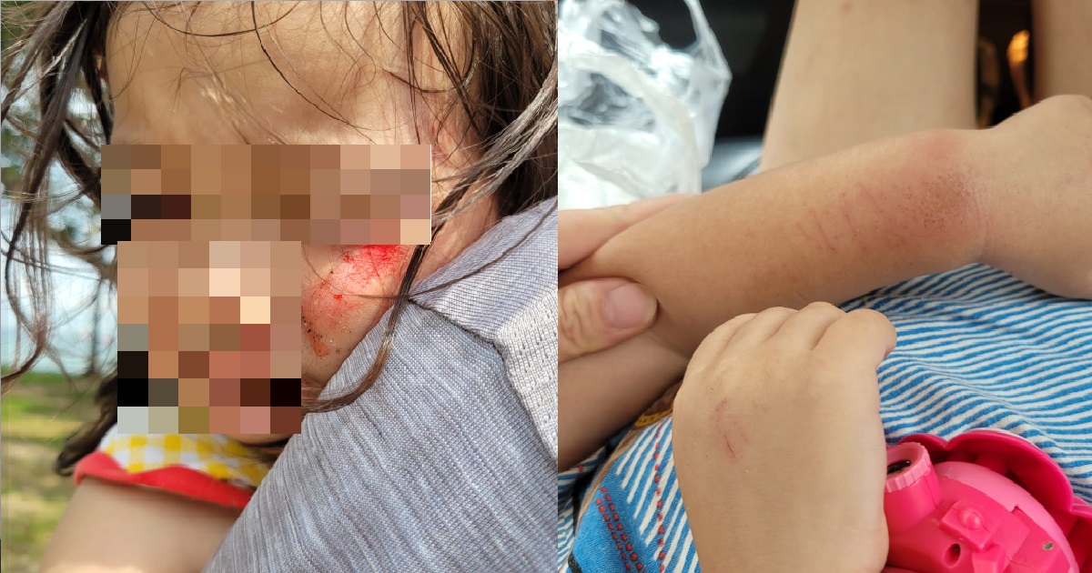 ANG MOH CYCLIST RUNS OVER WOMAN & TODDLER @ EAST COAST THEN GOES MIA