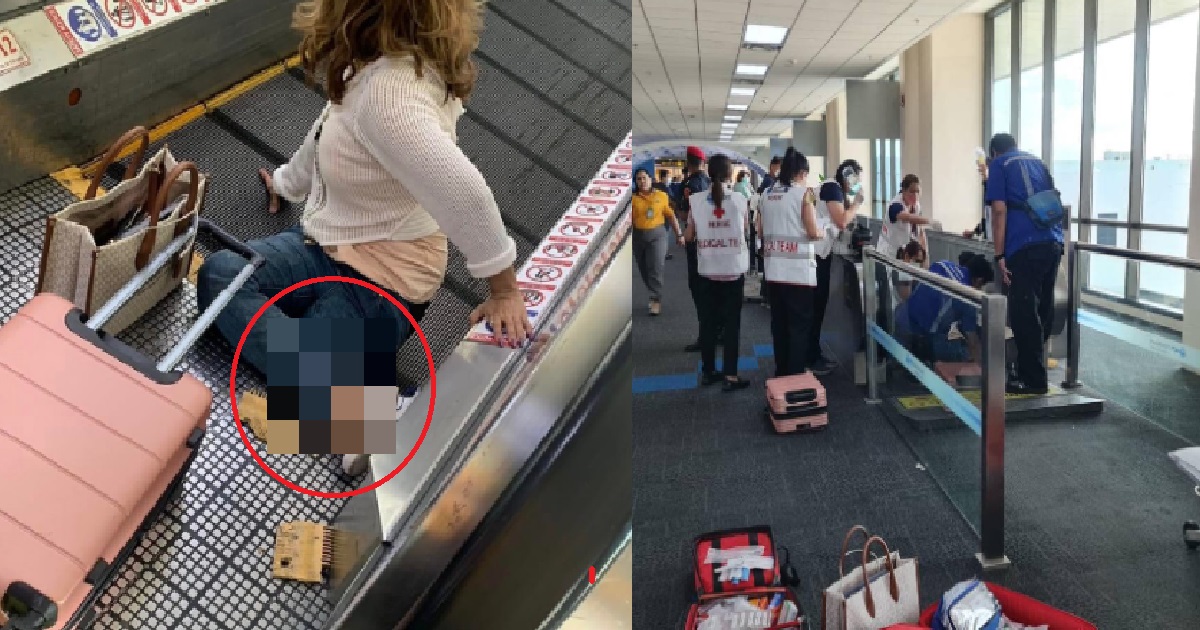 WOMAN’S LEG SEVERED AFTER IT GOT “SUCKED” INTO MOVING TRAVELATOR @ BKK AIRPORT