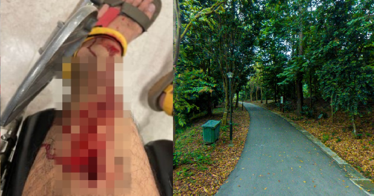 40 Y.O MAN ATTACKED BY WILD BOAR @ BUKIT PANJANG, END UP NEED MORE THAN 40 STITCHES