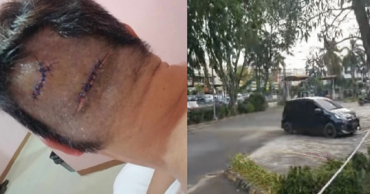 S’PORE MAN GOT ROBBED IN BATAM, LOST HIS CASH, PASSPORT, PHONE & END UP WITH 17 STITCHES
