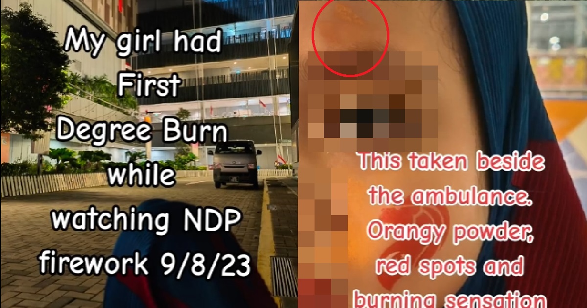 LITTLE GIRL ALLEGEDLY SUFFERS 1ST-DEGREE BURNS FROM NDP FIREWORKS @ TAMPINES