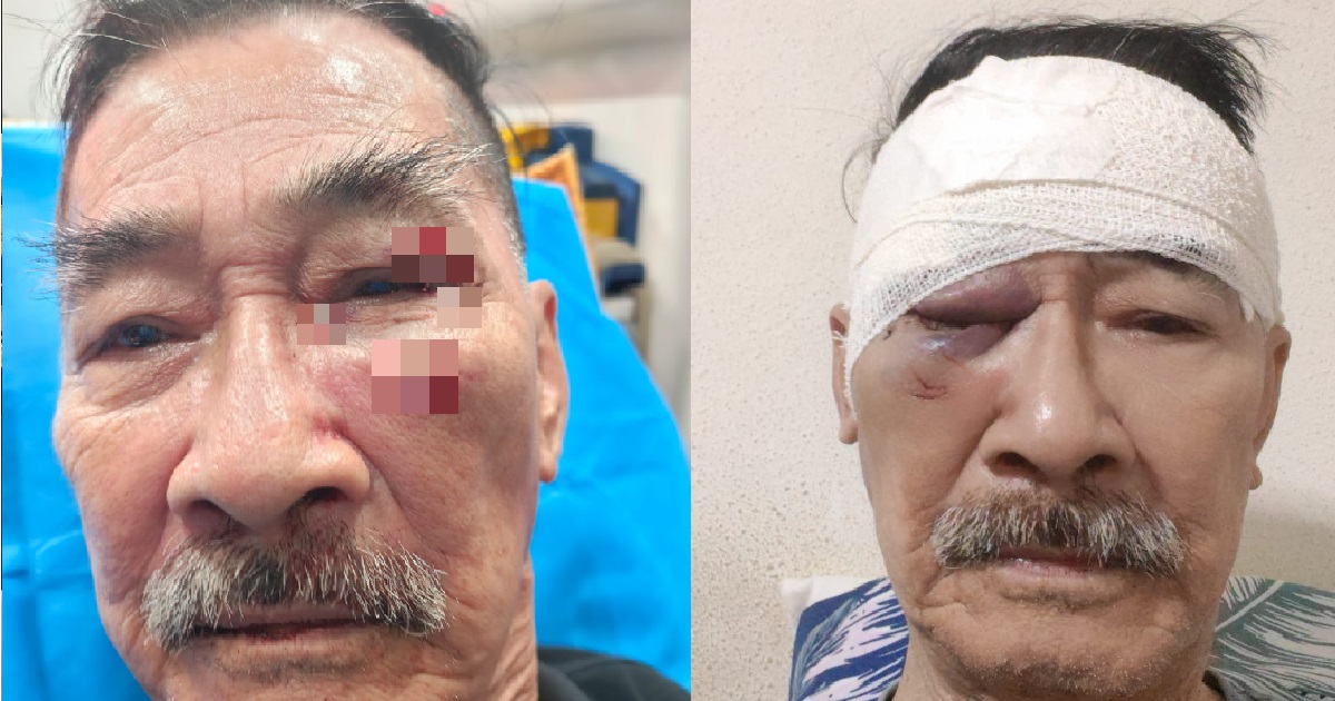80 Y.O SECURITY GUARD TOLD MAN NOT TO SLEEP ON BENCH, GETS PUNCHED IN THE FACE @ BEDOK