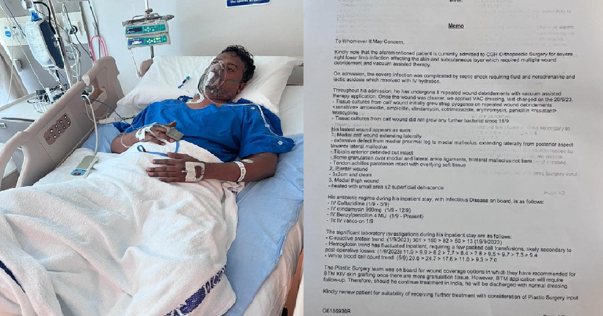 MIGRANT WORKER IN S’PORE INFECTED WITH FLESH-EATING BACTERIA, MOST OF RIGHT LEG REMOVED