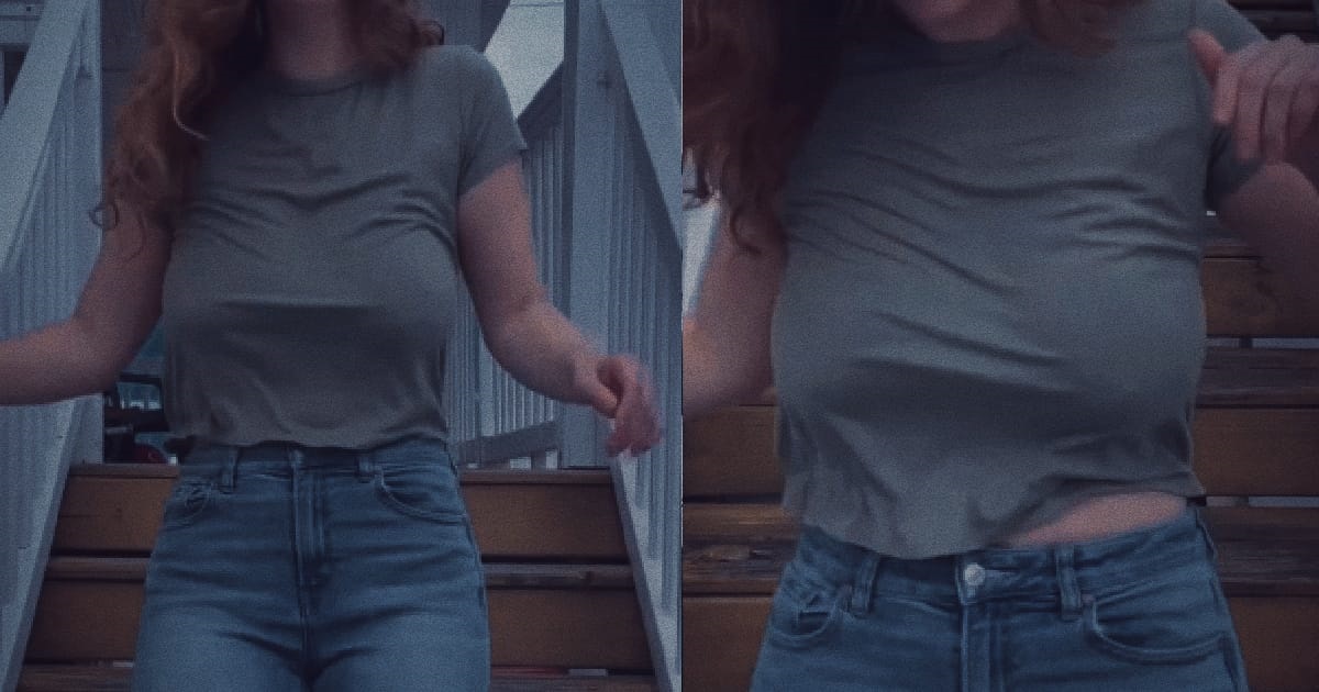 WOMAN LOST A LOT OF WEIGHT & HER NEHNEHPOK DEFLATED, NOW BECOME SAGGY