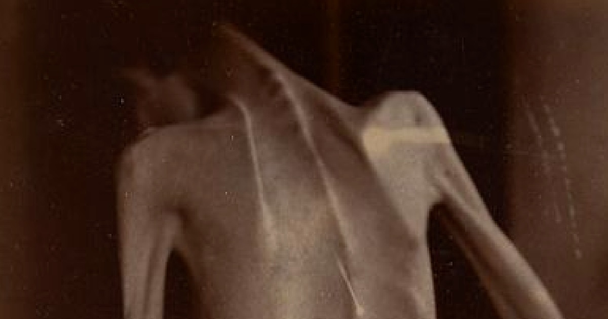 GF STARVES HERSELF BECAUSE SHE THINKS SHE’S FAT, BF HUG HER & CAN FEEL HER RIBS