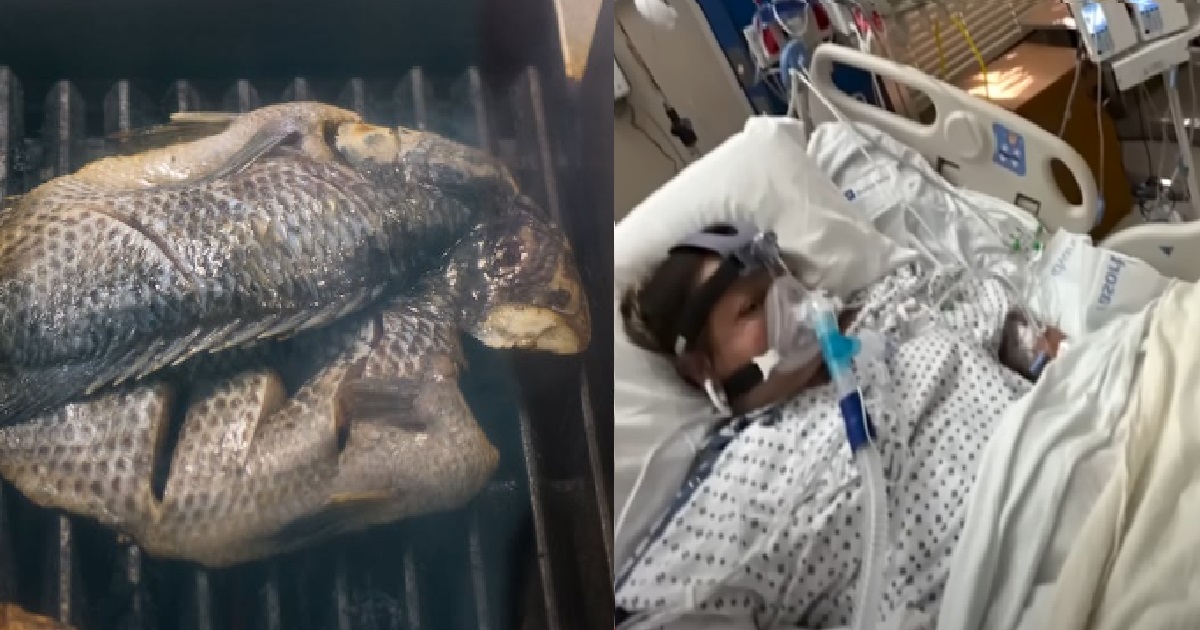 WOMAN ATE UNDERCOOKED FISH & GOT BACTERIAL INFECTION, BOTH ARMS & LEGS AMPUTATED