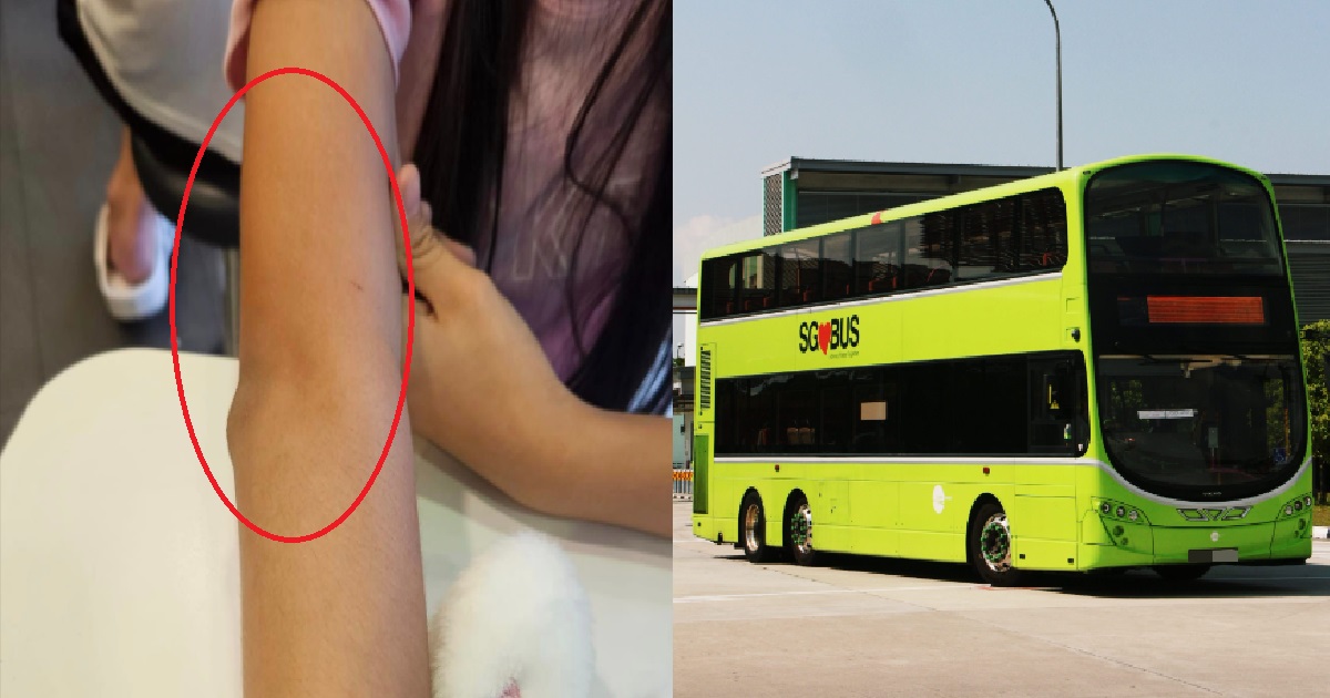 11 Y.O GIRL’S ARM KENA KIAP BY BUS DOOR, ANGRY DRIVER SCREAMS VULGARITIES INSTEAD