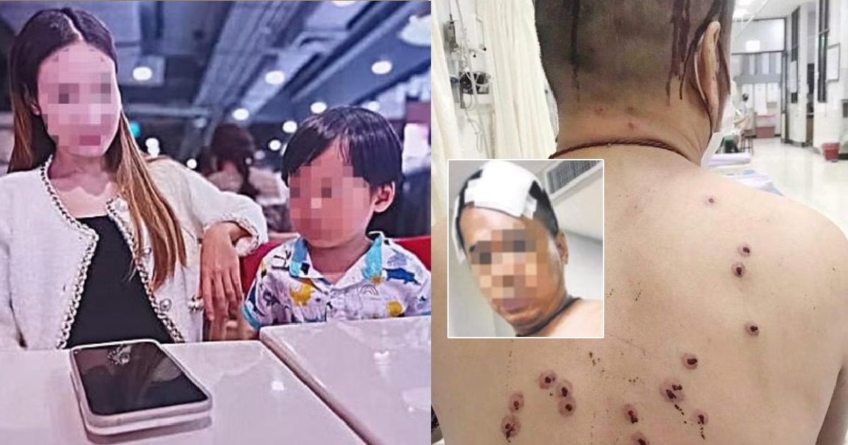 S”PORE MAN GOT SHOT 20 TIMES WITH AIR GUN BY 5 MEN WHO BROKE INTO HIS HOME IN THAILAND
