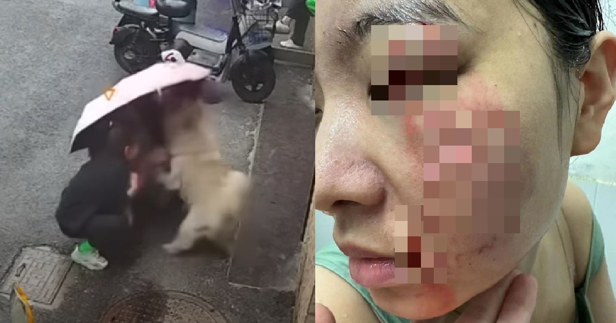 WOMAN PETS DOG ON STREET, GETS A CHUNK OF HER FACE BITTEN & TORN OFF BY THE DOG