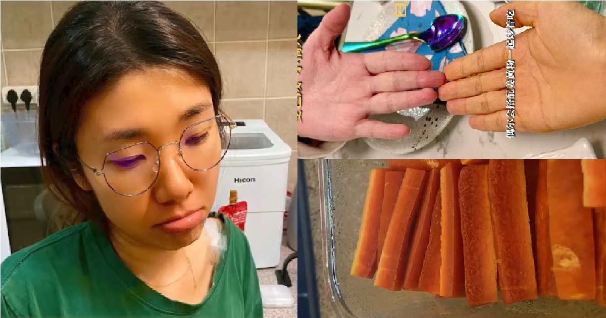 GIRL ATE ONLY CARROTS FOR 3 MONTHS, UNTIL SHE STARTS TURNING ORANGE