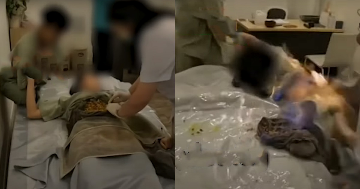 THAI WOMAN GOES UP IN FLAMES AFTER SEEKING “TREATMENT FOR AIR IN STOMACH”