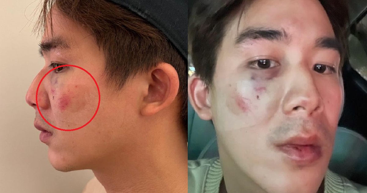 DIAM DIAM ERA ACTOR DANNY LEE KENA WHACKED IN TAIWAN FOR BUMPING INTO PARKED CAR